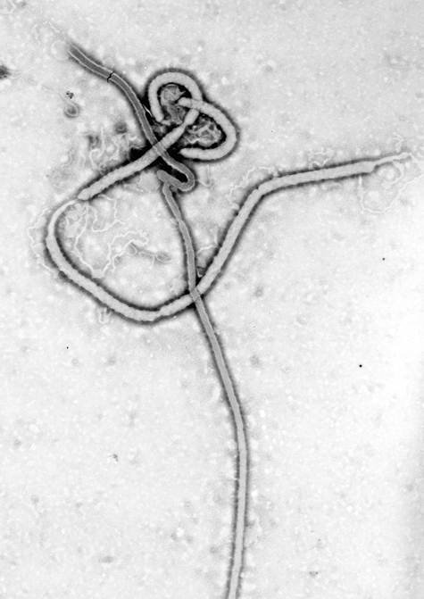 DRC Ebola outbreak pathogen shown in an electron microscope image of the Ebola virus