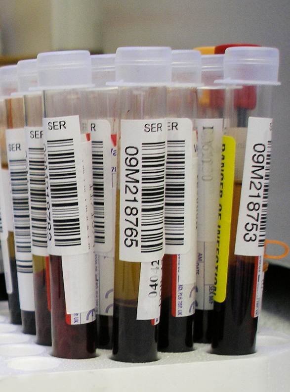 Dormant viruses research shown by labeled blood sample tubes used for viral analysis